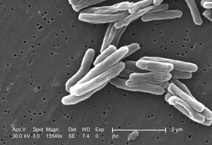 Мумии от 18 век помагат за откриване на туберкулоза
